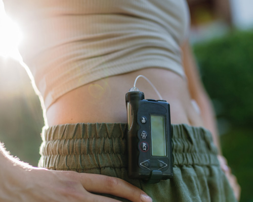 nanoGUARD 3D PCBA Protection